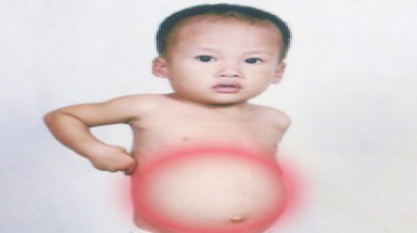 Đắng lòng cậu bé mắc bệnh hiếm gặp