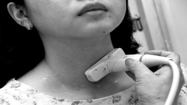  Người trẻ cũng bị ung thư tuyến giáp