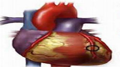 Đậu nành không giúp ngăn chặn tắc động mạch ?