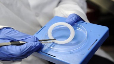  Phòng ngừa HIV bằng vòng âm đạo