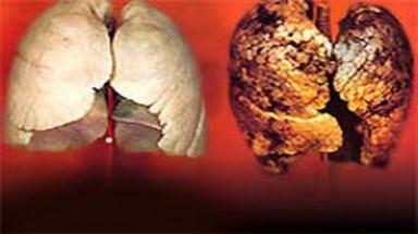 Hút 400 điếu thuốc, phổi sẽ đen kịt như… nước cống