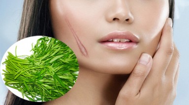  Thực hư chuyện ăn rau muống gây sẹo lồi