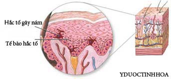 Trị[-]nám[-]da[-]với[-]y[-]học[-]cổ[-]truyền,[-]Sức[-]khỏe[-]đời[-]sống,[-]