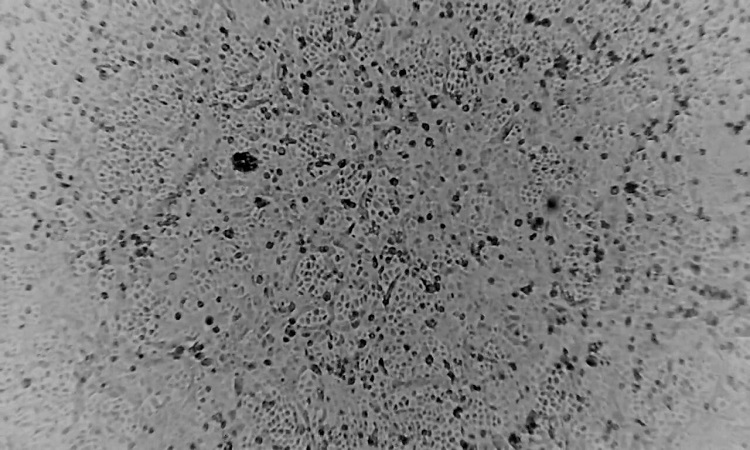 Lần[-]đầu[-]tiên[-]tái[-]tạo[-]virus[-]corona[-]ngoài[-]Trung[-]Quốc