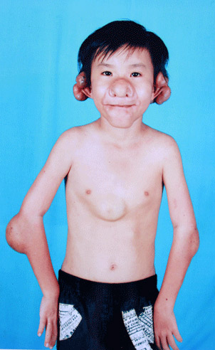 [-]Cậu[-]bé[-]Bùi[-]Nhật[-]Minh[-]Tiến